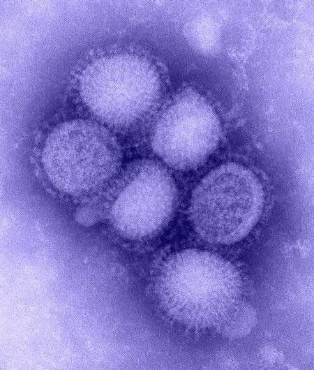 What is Novel H1N1?