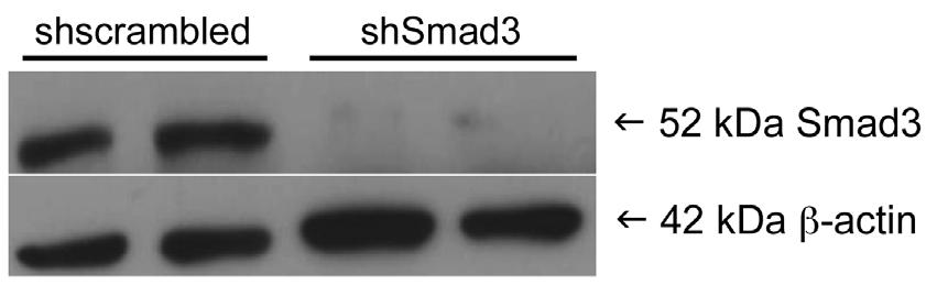 6 Supplementary Figure 5 Silencing of Smad3 protein by lentivirally delivered shrna. THP-1 cells were incubated with lentivirus containing either scrambled shrna or shrna to Smad3.