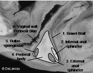 Define the Anatomic Defect 1 1. 1. Bowel wall 2.