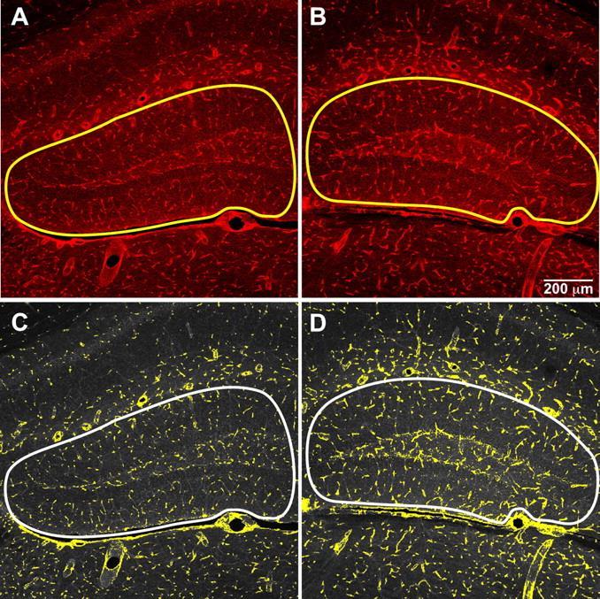 Flavanols increase angiogenesis Control Epicatechin Lectin-stained