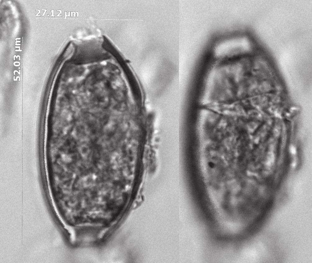 Kelsey J. Kumm, Karl J. Reinhard, Dario Piombino-Mascali, Adauto Araújo FIGURE 5. Fracturing was exhibited by a few eggs. In the case of this egg, the shell fractured and filled with digesta.