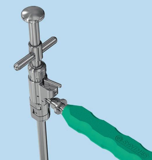 Implantation 7 Insert implant 2 Instrument 03.807.300 XRL Spreader Prior to inserting the implant the spreader handle can be rotated at 90 increments to aid in visualization.