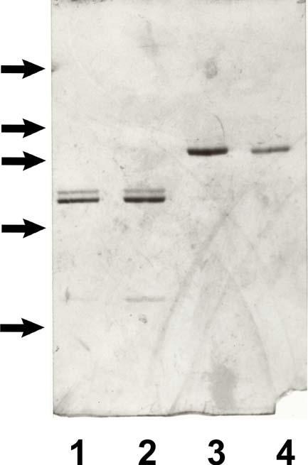 Figure 3-2. Polyacrylamide gel electrophoresis of the isolated heavy and light chains of human and bovine factor Va.