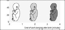 approximately 2 3 minutes allows a placental transfusion of 35 4 ml blood per kg bodyweight (term infants) For a 3.