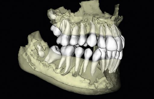 View bone, teeth, and facial profile with face-match Extended view available when more anatomical information is needed A 3D scan allows orthodontists to view the greater craniofacial complex, with