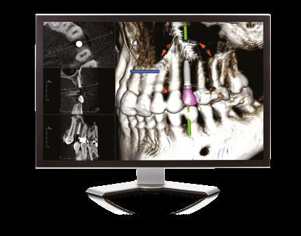 access to integrated treatment tools for implant planning, surgical guides, and other applications.