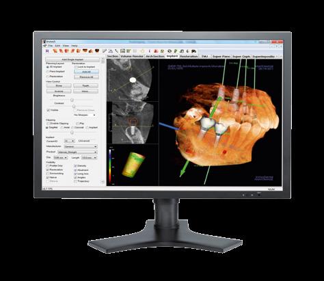 dental office. Our comprehensive 3D imaging solution provides the fastest scan to plan workflow.