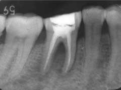 145 At the next visit, the gingival swelling had disappeared (Fig. 5).