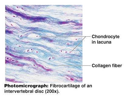 Types of Connective Tissue Fibrocartilage Highly
