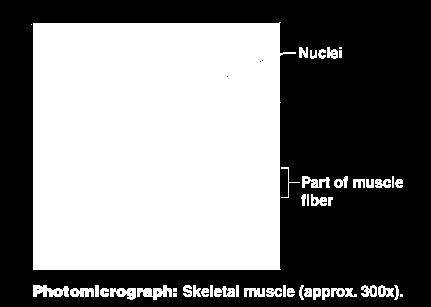 Types of Muscle Tissue Skeletal muscle Can be controlled voluntarily Cells