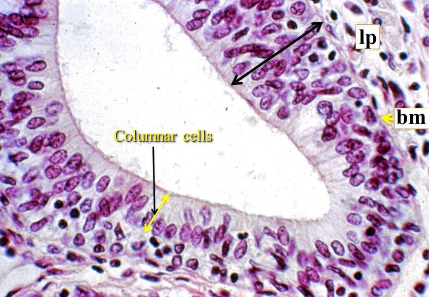 7- Stratified columnar epithelium It is a rare type of epithelial tissue composed of column shaped cells arranged in multiple