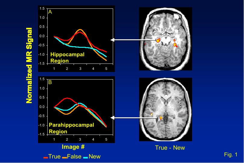 Can the Brain Distinguish True from Imagined (False) Memories?