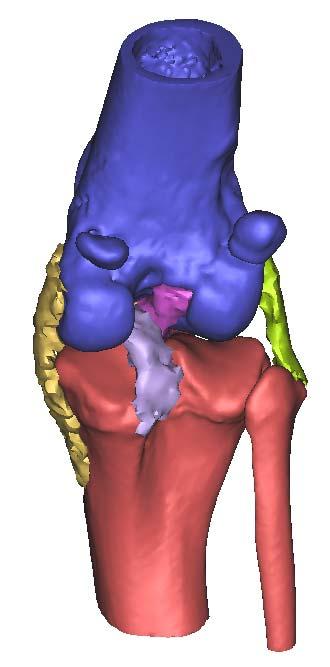 Femur CrCL MCL LCL CaCL Tibia Fibula FIGURE 24 - Caudal aspect of the stifle reconstructed from medical imaging data.