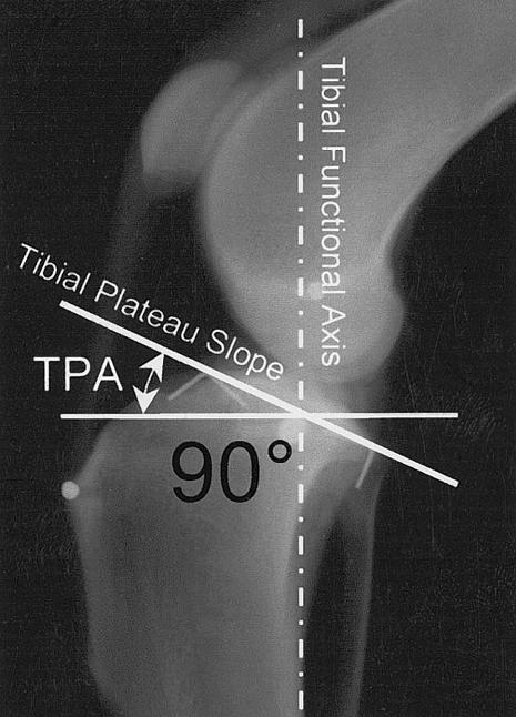 FIGURE 10 - Radiograph of the canine stifle and tarsus joints depicting the determination of the tibial plateau slope (Warzee, Dejardin et al. 2001).