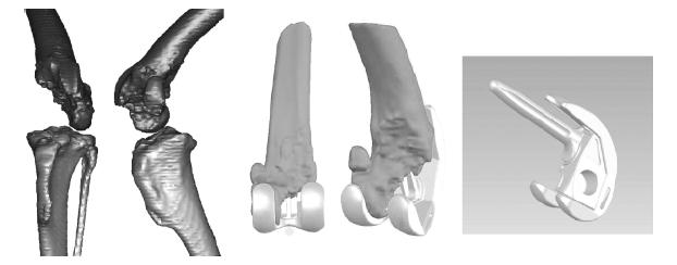 cranial-caudal translation through the implant (Liska, Marcellin-Little et al. 2007). The implant is displayed in FIGURE 20.