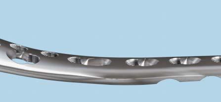5 mm LCP Low Bend Medial Distal Tibia Plate is part of the Synthes locking compression plate (LCP) system that merges locking screw technology with conventional plating techniques.