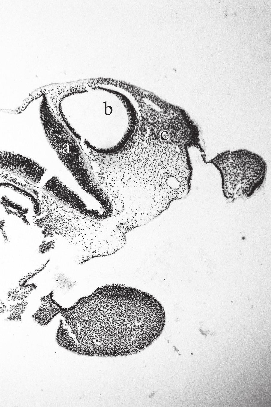 A. Bruska et al., Human facial-vestibulocochlear complex Figure 4. Horizontal section of head in embryo at stage 13.