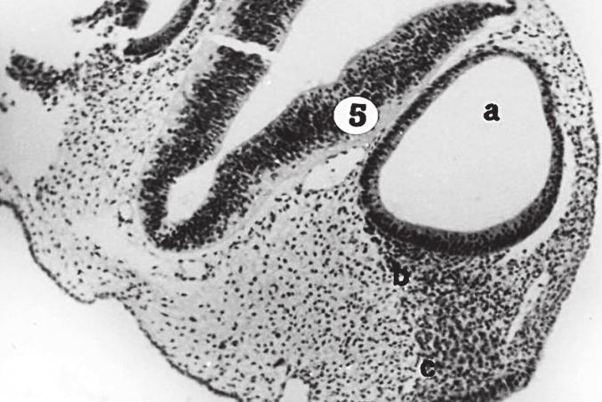 Horizontal section of embryo at stage 13. Bodian s protargol, 40; a rhombomere 5, b otic vesicle, c facial-vestibulocochlear ganglionic complex. Figure 3.