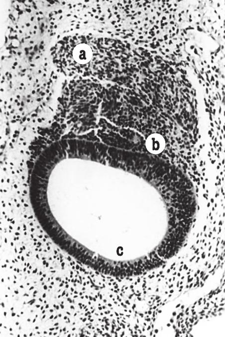 H + E, 200; a geniculate ganglion, b vestibulocochlear ganglion, c otic vesicle.