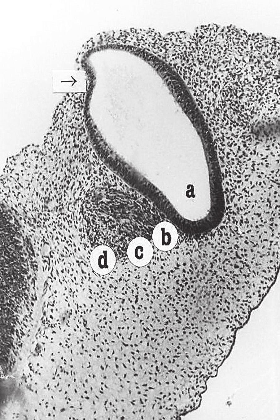 A. Bruska et al., Human facial-vestibulocochlear complex Figure 12. Section as in Figure 11 (stage 14).