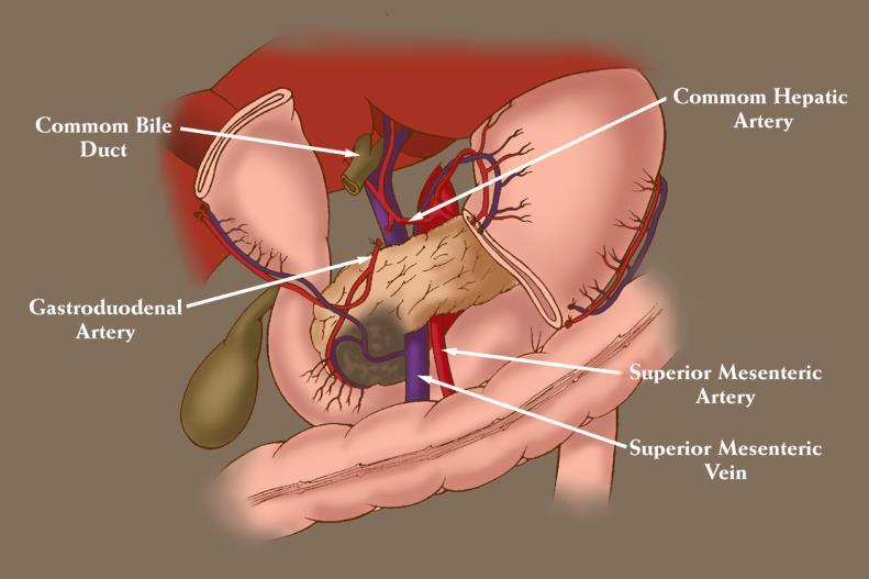 Step 4: gastric transection