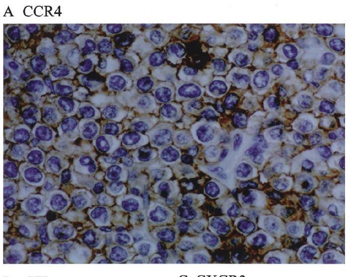Overall survival (%) CCR4 expression in ATL 91 (88.3 %) of the 103 cases of patients with ATL were positive for CCR4.