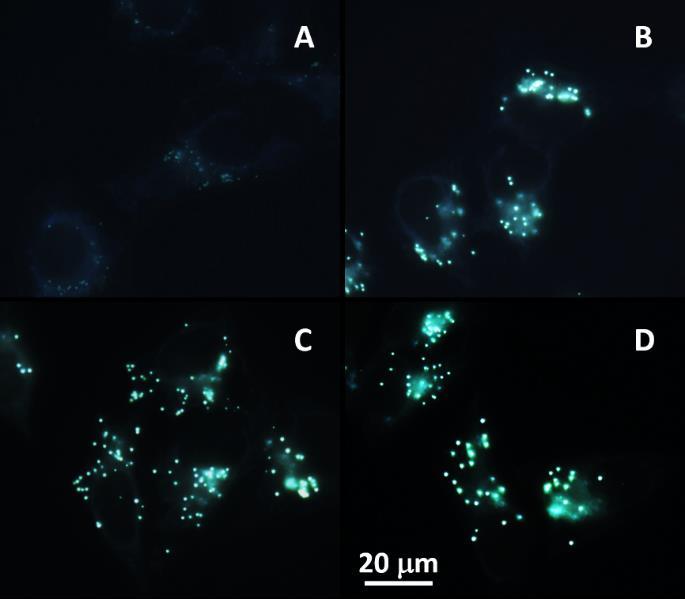 Fig. S4 Fluorescent images of HeLa cells stained with () 2, () 1, (C) 2 and (D) 5 μm TPE-ml for 15 min. Excitation wavelength: 33-385 nm.