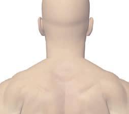 Neck and collar area Zone 3.