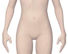 172 Lower abdominal pain (algodismenorrhea, inflammatory diseases of female reproductive organs) Main zones 1.
