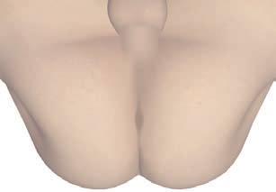 176 Lower abdominal pain and genitals pain (prostatitis, urethritis, orchitis, algodismenorrhea) Main zones 1.