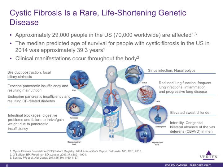 Cystic fibrosis is a rare life-long genetic disease that affects approximately 29,000 people in the United States and about 70,000 worldwide regardless of race or ethnicity but is more common in