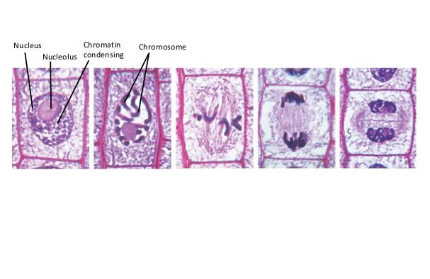 D. Anaphase The chromatids of each chromosome separate at the centromeres when the cohesion proteins are cleaved. The chromosomes move to opposite poles of the cell, forming daughter chromosomes.
