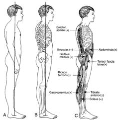 Neck muscle proprioceptors are more important for balance control The visual and labyrinthine inputs are located in the head, and they help orient head position However, since the position of the