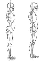 Lordosis (findings) Possible tight muscles Lower back (erectors) Hip flexors Possible weak muscles Abdominals (especially obliques) Hip extensors Kyphosis (findings) Possible tight muscles Internal