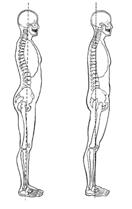 Flat-back (findings) Possible tight muscles Upper abdominals Hip extensors Possible weak muscles Lower back