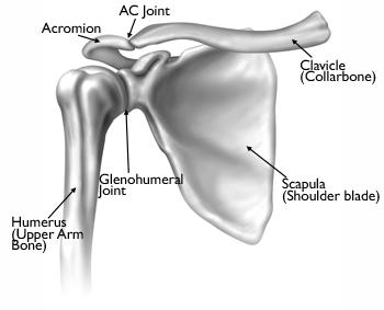 Arthritis of the Shoulder Simply defined, arthritis is inflammation of one or more of your joints. In a diseased shoulder, inflammation causes pain and stiffness.