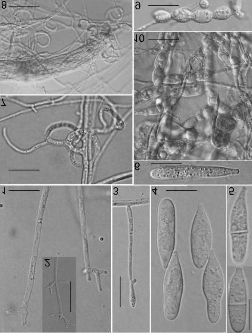 Figs. 1-10. Arthrobotrys yunnanensis sp. nov. (from holotype: HT1.00593). 1, 2. Conidiophores with short denticles. 3. An unmature conidium attached to a conidiophore. 4-6.