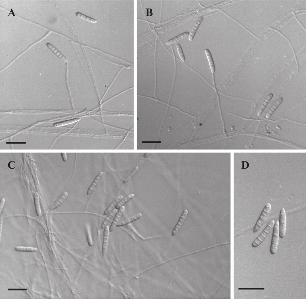 129 Fig. 1. Dactylella coccinella (Holotype HMAS 87787). A-B. Conidiophores with attached conidia. C. Conidia. D. Magnification of conidia showing septa. Scale bar = 10 µm.