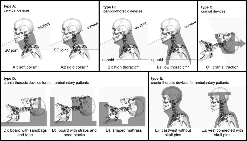 Young children sustain injury primarily to the upper cervical spine (C1-C4), whereas
