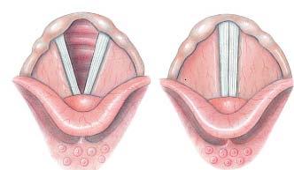 Inside the Larynx Rima Glottis True Vocal Cords