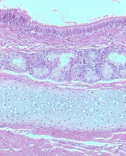 Trachea Pseudostratified Columnar Epithelium