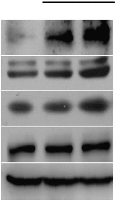 Original magnification,. Scale bar, 5 mm. (b) UP and other related protein expression in HT/ adipocytes treated with vehicle and (.5 mm and.5 mm, respectively).