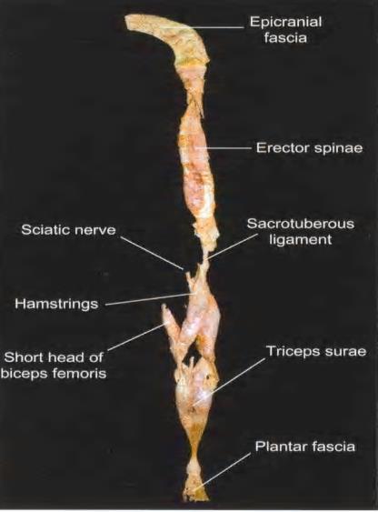 Thoracolumbar fascia Erector