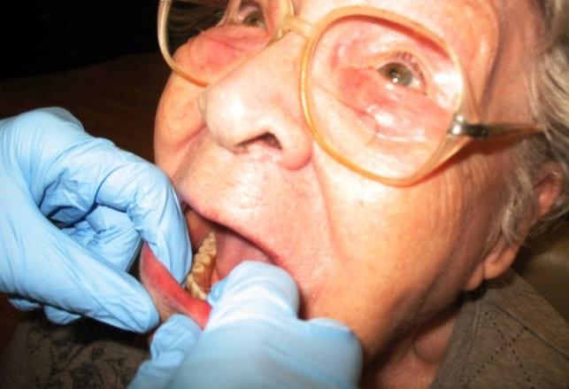 clinician good access to lift the lip and view inside the mouth A