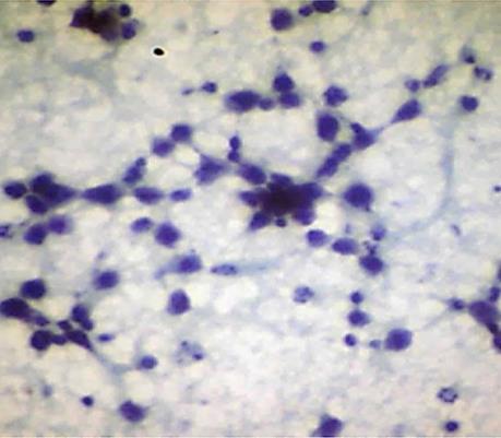 H&E x400 c) Lymphoid cells