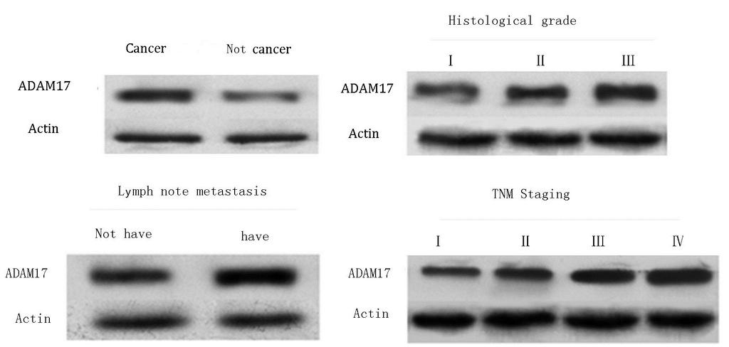 H.B. Liu et al. 4394 ADAM17 protein expression detected by Western blotting is reported as means ± standard deviation and the Student t-test was used to compare groups.