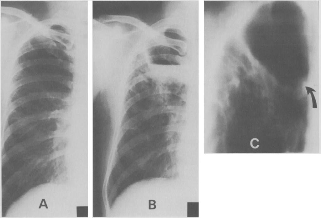 ~ ~~~~~~ 682 The Annals of Thoracic Surgery Vol46 No 6 December 1988 Fig 5.