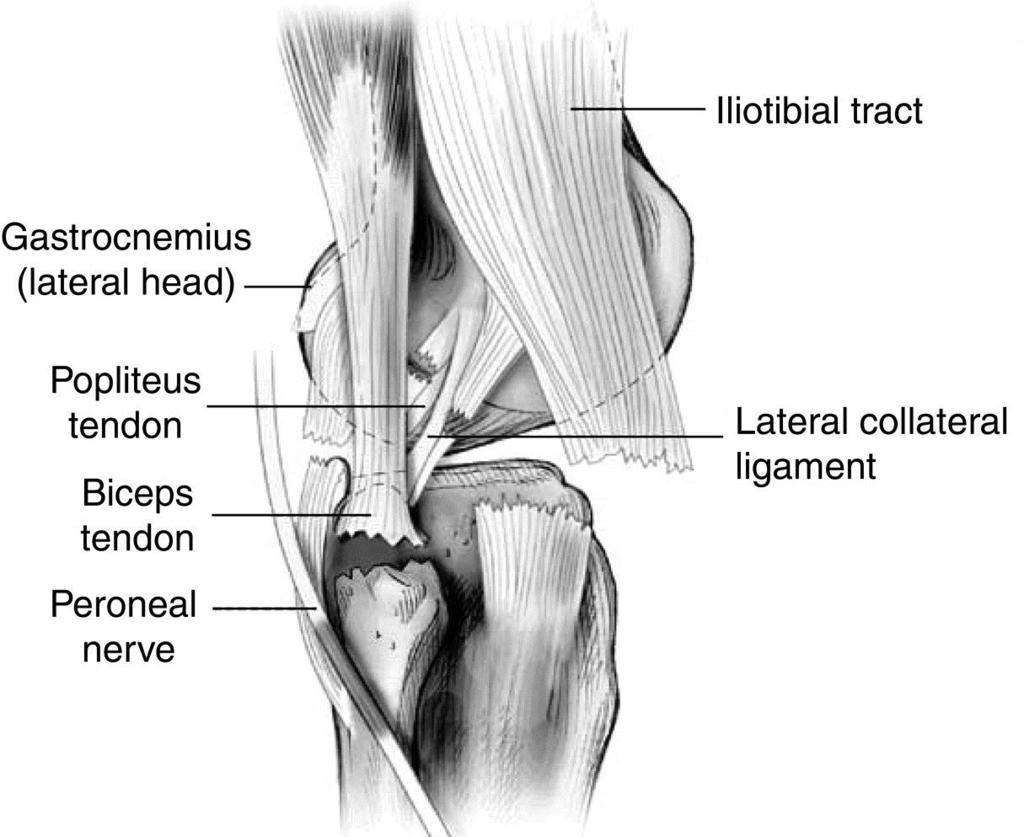 Knee Locked knee Postero-lateral corner Extensor
