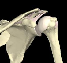 This analogy is used because the articular surface of the round humeral head (upper most part of the arm) is approximately four times greater than that of the relatively flat shoulder blade face