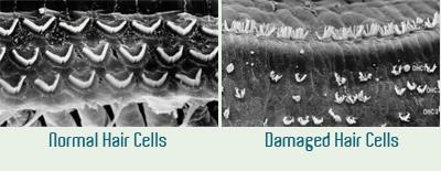 Sensory cells can be damaged These fine sensory cells cannot be regenerated in